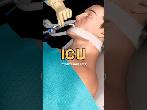 What happens in ICU ?