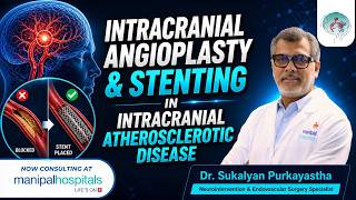 Intracranial Angioplasty | Dr. Sukalyan Purkayastha | Brain Mechanic
