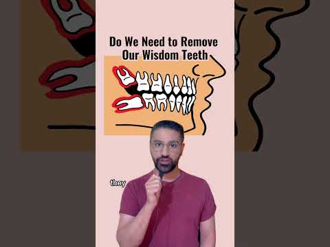 Do you need to remove your wisdom teeth?