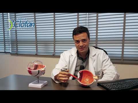 Dr Juan Manuel -Tipos de glaucoma