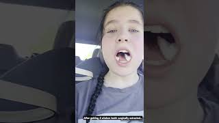 Wisdom teeth extraction 🥴 #wisdomteethremoval #postsurgery #anesthesia #aftersurgery #wisdomteeth