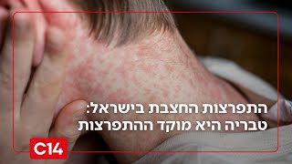 משרד הבריאות הגדירו את טבריה כמוקד התפרצות לאחר שהתגלו יותר מ-7 מקרים בעיר (חדשות ערוץ 14) - התמונה מוצגת ישירות מתוך אתר האינטרנט יוטיוב. זכויות היוצרים בתמונה שייכות ליוצרה. קישור קרדיט למקור התוכן נמצא בתוך דף הסרטון