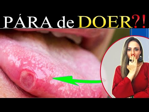 KILLER TIP to heal that Bruised Tongue/Mouth with 1 ingredient!!!