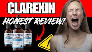Clarexin Reviews UK - Is Clarixin Legit? -  My Shocking Results!