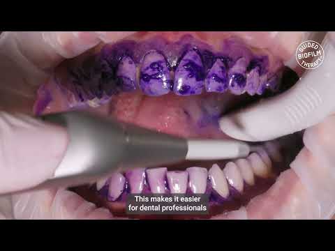 BIOFILM DISCLOSER - MAKING OUR WORK LIFE EASIER I GBT Microlearning with Dr. Hanan Abdalla