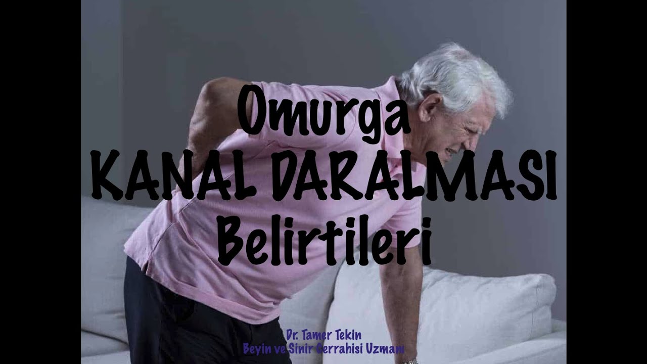 Omurga Kanal Daralması Belirtileri