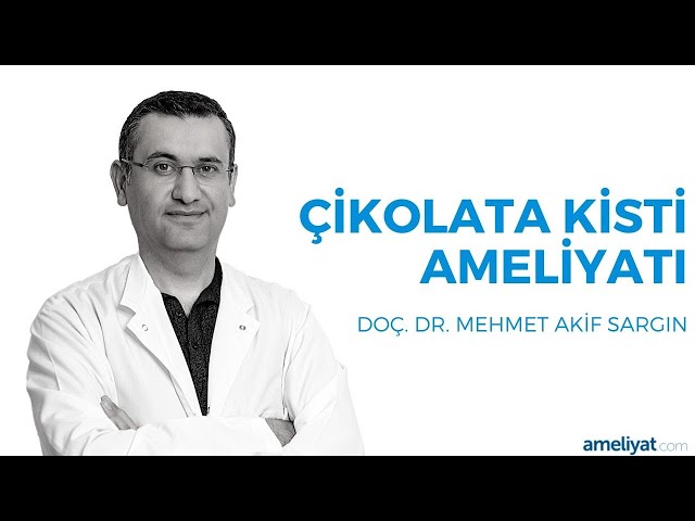 Çikolata Kisti Tedavisi