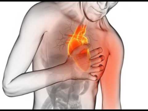 Procédé Mesnik NG dans le traitement de lhypertension Lhypertension artérielle chez un enfant est