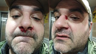 სამოქალაქო აქტივისტ რომან აკოფოვის თქმით, ქუჩაში უცნობი პირები ფიზიკურად გაუსწორდნენ