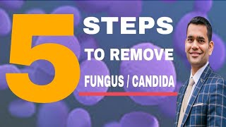 5 STEPS TO TREAT FUNGAL INFECTION ( CANDIDA ) | Dr. Vivek Joshi