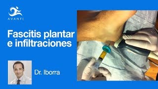 Infiltraciones para la Fascitis Plantar Podología Dr. Iborra