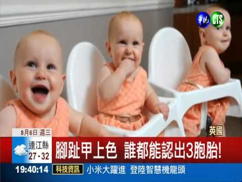 "趾"要看顏色! 輕鬆分辨3胞胎