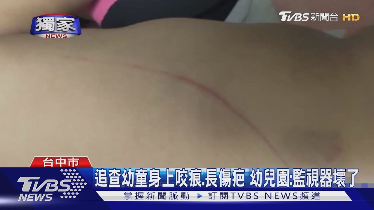 直擊!教育局稽查是否虐童 幼園竟整車載走