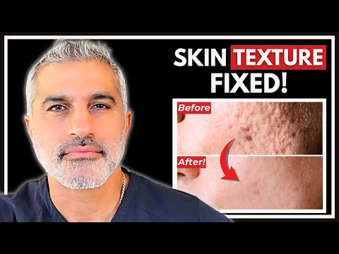 How to Treat Skin Texture & Acne Scars - What Actually Works (Doctor Explains)
