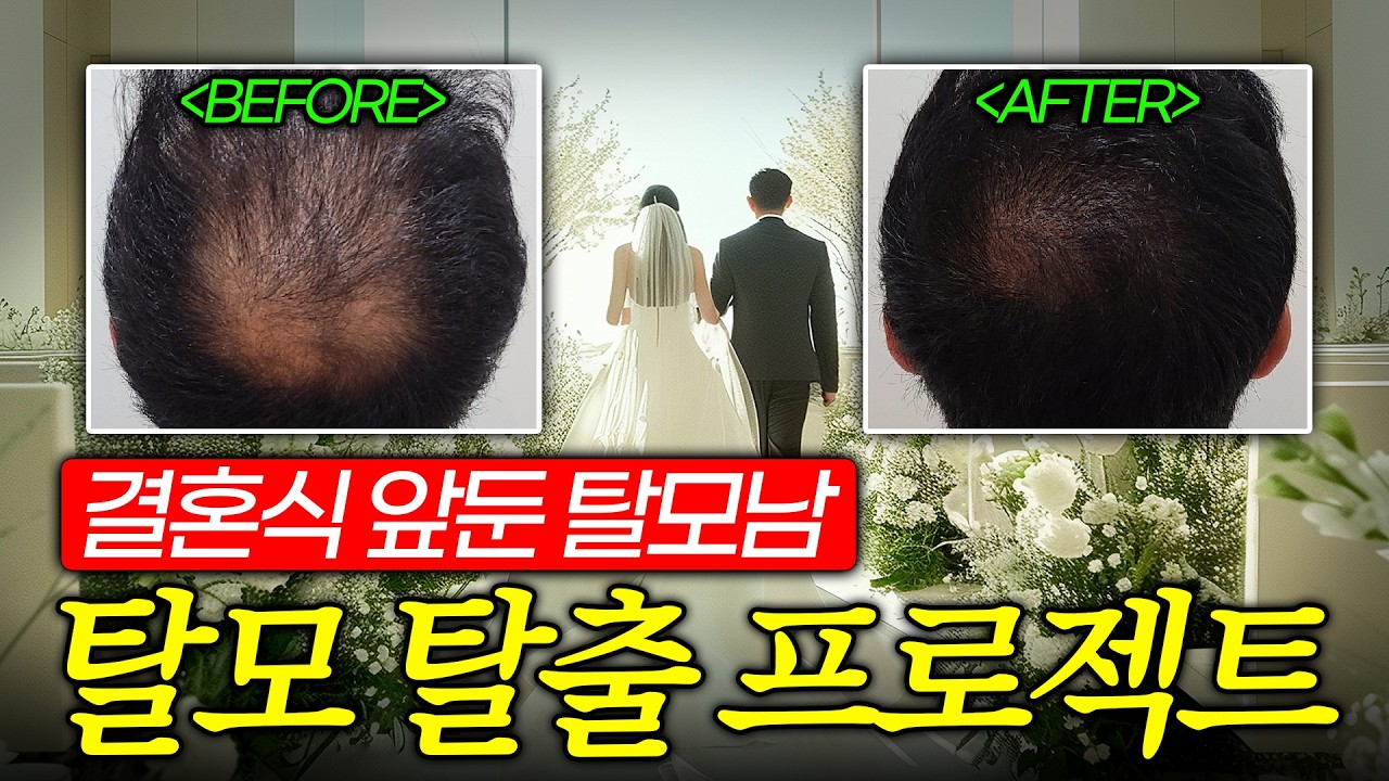 더원츠의원 유튜브