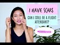 SCARS: Can I Still Be a Flight Attendant? By Misskaykrizz SCARS: Can I Still Be a Flight Attendant? By Misskaykrizz