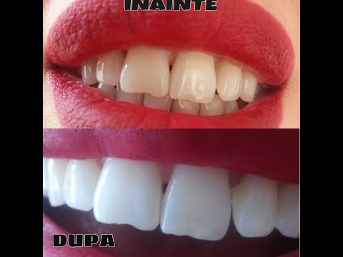 Canzoni di testo di sorriso di lentiggine di gruppo Lentiggini deposito in linea di un kidswear
