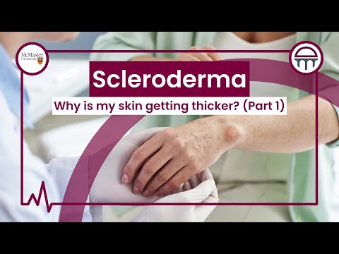 An Overview of Scleroderma Part 1: Breaking it down