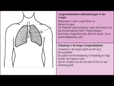 JUnidoks soljutab für Prostatitis Prostata-Abszess im Rektum