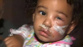 Toddler expected to be OK after attacked by pitbull-mix in Miami