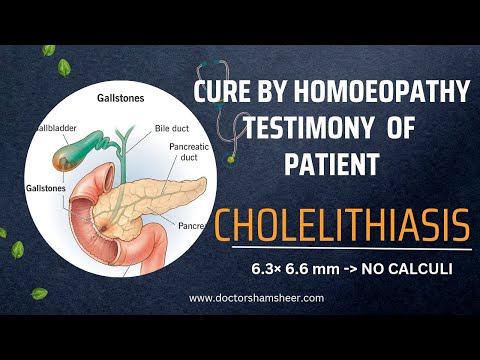 CHOLELITHIASIS - CURE BY HOMOEOPATHY; TESTIMONY OF PATIENT