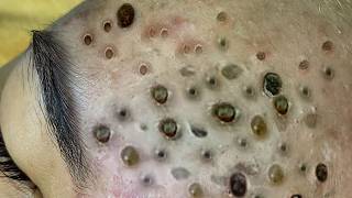 𝐑𝐞𝐟𝐫𝐞𝐬𝐡 𝐘𝐨𝐮𝐫 𝐅𝐚𝐜𝐞 𝐖𝐢𝐭𝐡 LNG 𝐒𝐤𝐢𝐧 𝐂𝐚𝐫𝐞 #