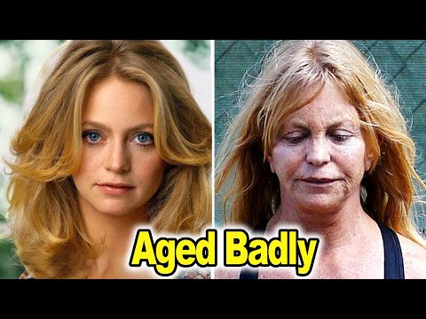 25 Celebrities Who Have Aged Badly