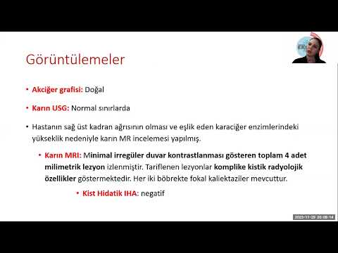 Emek Gerektiren Olgular EGO 29 kasim 2023