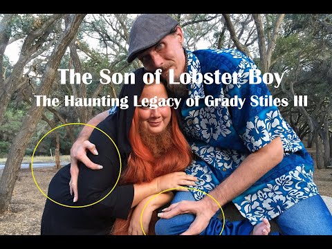 The Son With Claws - The Haunting Legacy of Lobster Boy’s Son | Grady Stiles III – The Last Claw?
