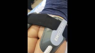 Download lagu Bagian 3 Dapatkan Bokong Bulat yang Indah! Perawatan Bokong TERBAIK tanpa Operasi di Arviv Medical! mp3 Download lagu Bagian 3 Dapatkan Bokong Bulat yang Indah! Perawatan Bokong TERBAIK tanpa Operasi di Arviv Medical! mp3