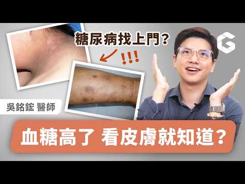 血糖高皮膚會求救！這些症狀代表健康亮紅燈？