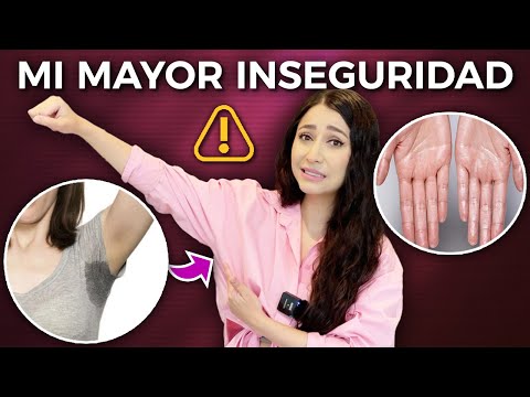 My greatest INSECURITY😳 l Storytime👩🏻⚕️