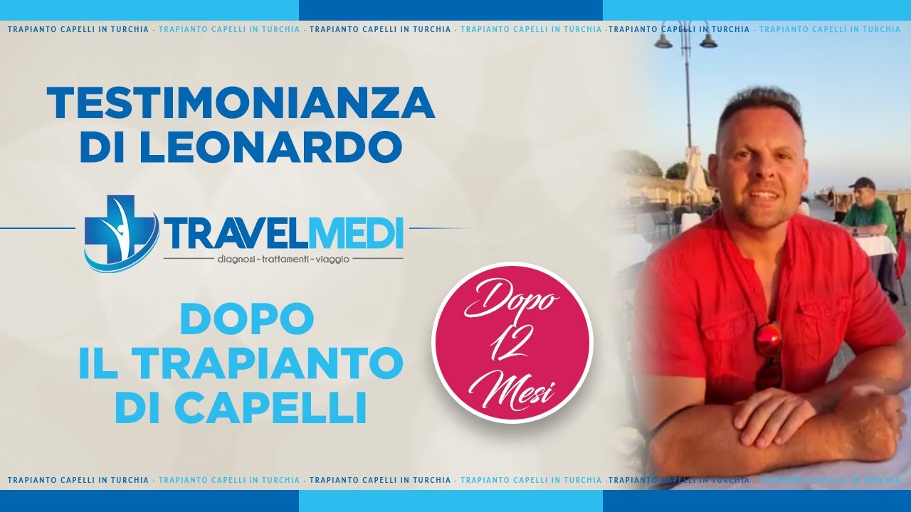 Leonardo from Italy sharing his hair transplant experience after twelve months