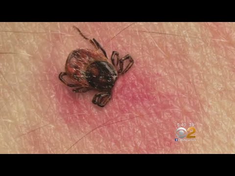 New & Improved Testing Could Make Detecting Lyme Disease Easier