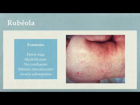 Exanthematous diseases in pediatrics