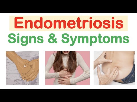, title : 'Endometriosis Signs & Symptoms (& Why They Occur)'