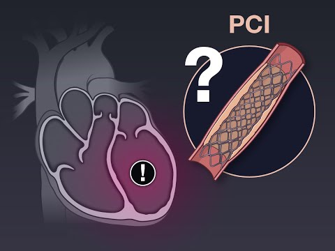 PCI for Ischemic Left Ventricular Dysfunction | NEJM