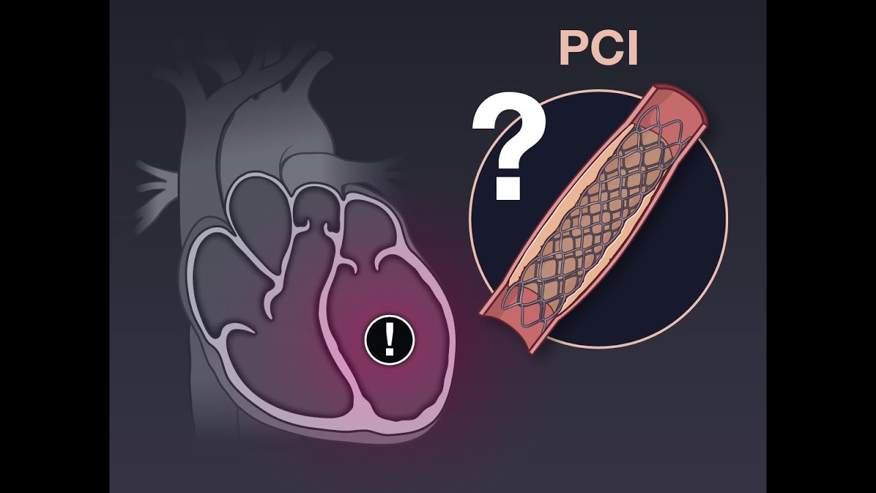 PCI for Ischemic Left Ventricular Dysfunction | NEJM