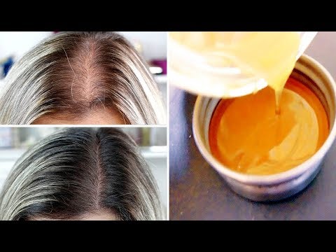 Die Mykose der Nägel und seine Behandlung Klotrimasol die Creme gribok die Füsse