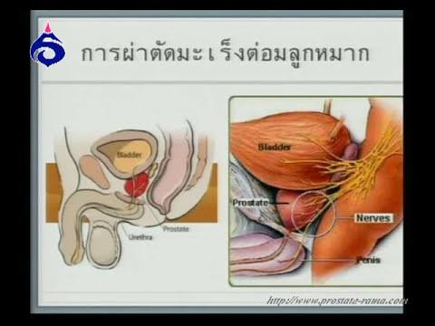 Exciter สำหรับผู้หญิงในร้านขายยา Ulyanovsk วิธีธรรมชาติเพื่อเพิ่มความแข็งแรง