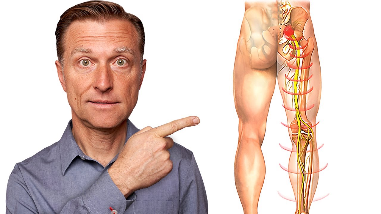Say Goodbye to Sciatica Nerve Pain in 5 Minutes