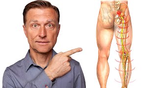 Say Goodbye to Sciatica Nerve Pain in 5 Minutes
