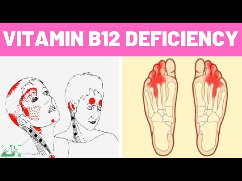 Vitamin B12 Deficiency Symptoms That Should Never Be Ignored