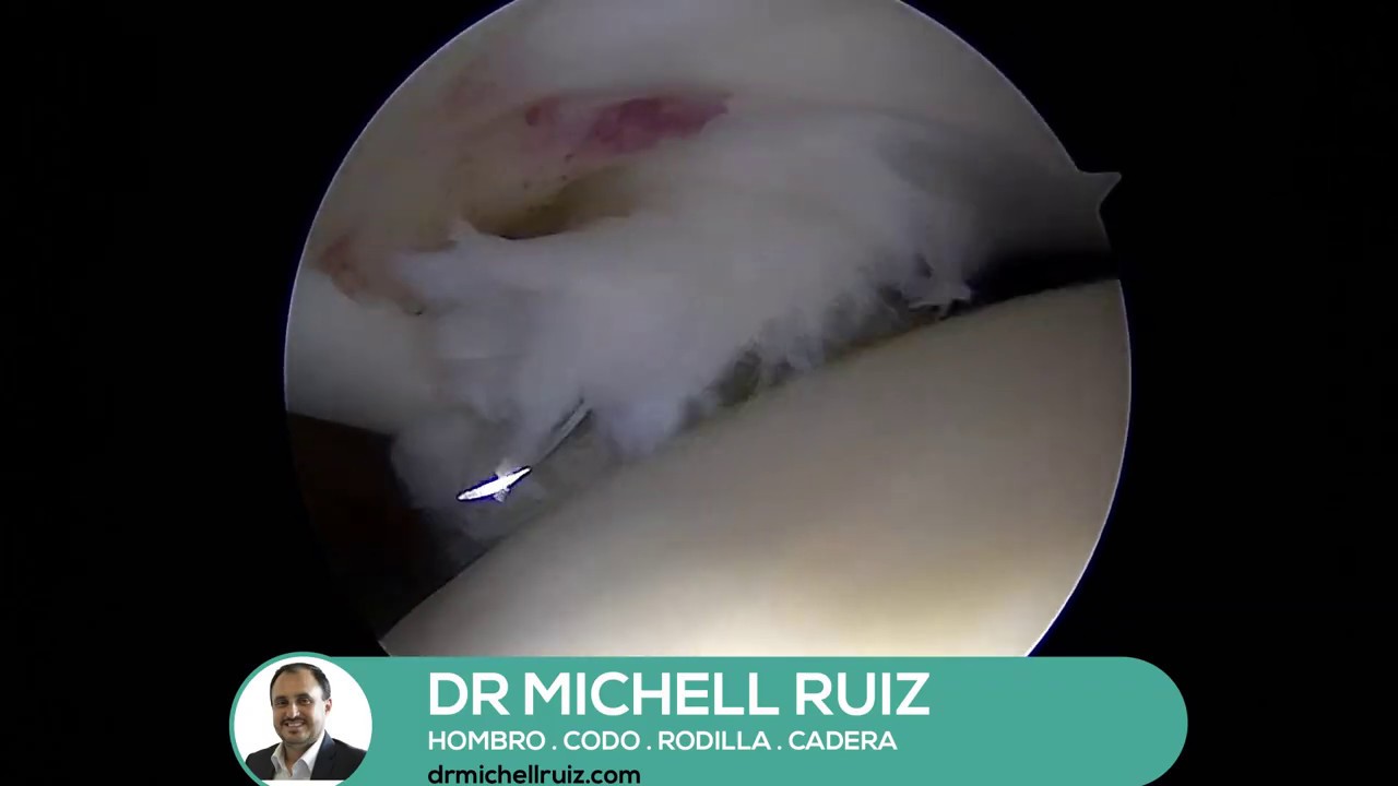 Michell Ruiz Suárez-4