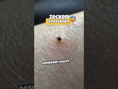 Zecken entfernen mit Zecken-Zange 🕷️