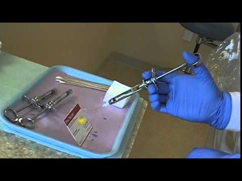 Local Anesthetic Syringe Assembly