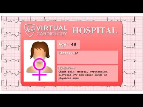 Ischemia 7/7 - Examples of STEMI