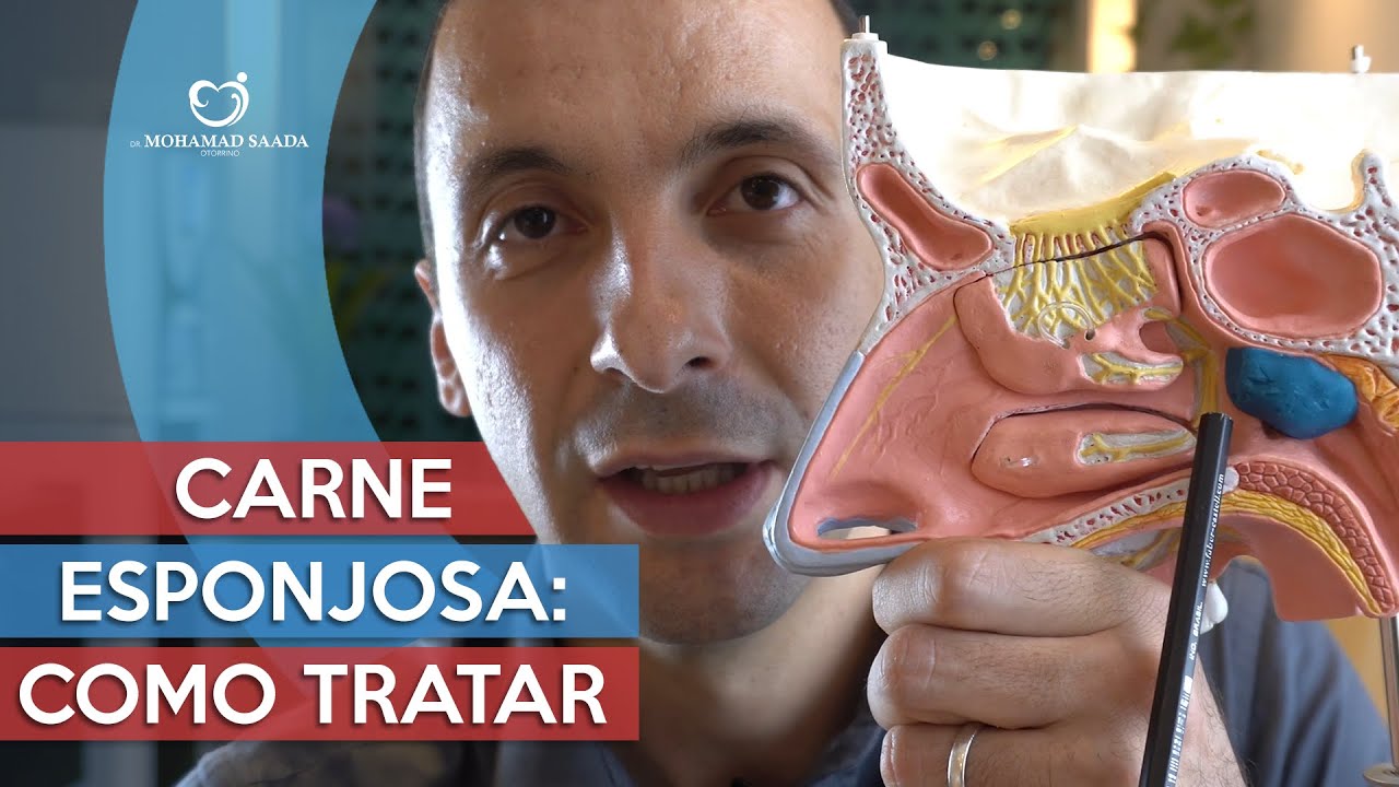 Carne Esponjosa: O Que é, Sintomas e Como Tratar