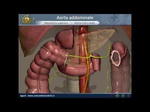 Torcicollo e osteocondrosi Spostamento vertebra nei sintomi della colonna cervicale