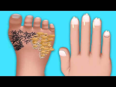 Beauty Care - Gameplay Walkthrough - All Levels (IOS, Android) - YouTube